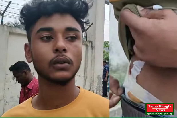 চলন্ত সিএনজিতে দুঃসাহসিক ছিনতাই, আহত যুবক।