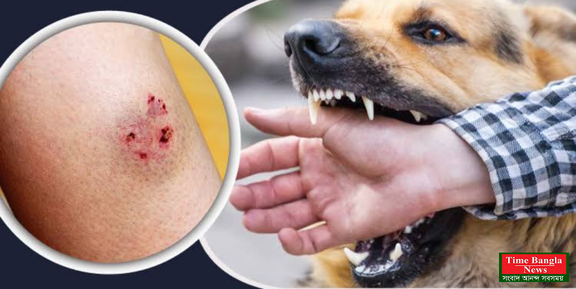 কুকুরের কামড়ে জলাতঙ্ক রোগীর মৃত্যু প্রায় অনিবার্য।