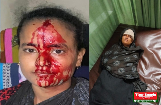 ওসমানীনগর প্রকাশ্য দিবালোকে দুই নারী ছিনতাইয়ের শিকার আহত ৩